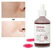 Пилинг-сыворотка гликолевая - Esthetic House Toxheal red glyucolic peeling serum, 100мл