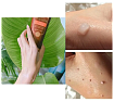 Гель мягкий с экстрактом плаценты 180мл 3W CLINIC Premium Placenta Soft Peeling Gel
